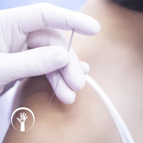 Formação em Dry Needling — Punção Seca